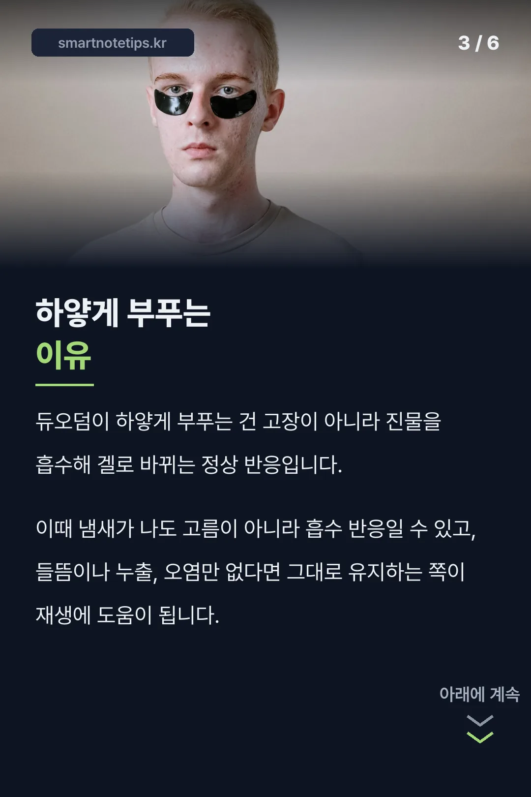 하얗게 부푸는 이유